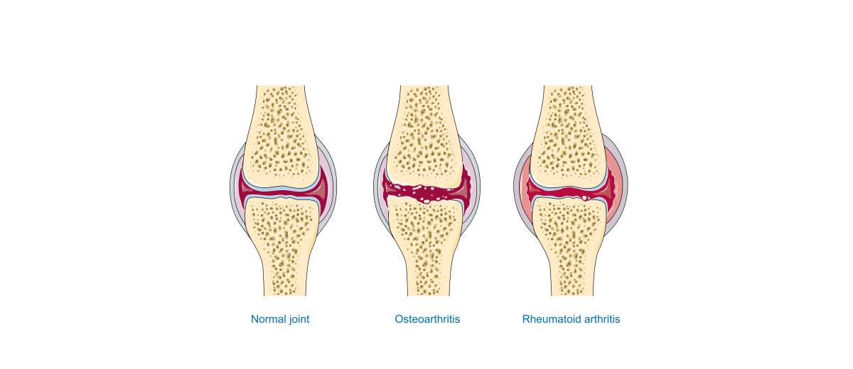 Immuungemedieerde artritis bij een Leonberger