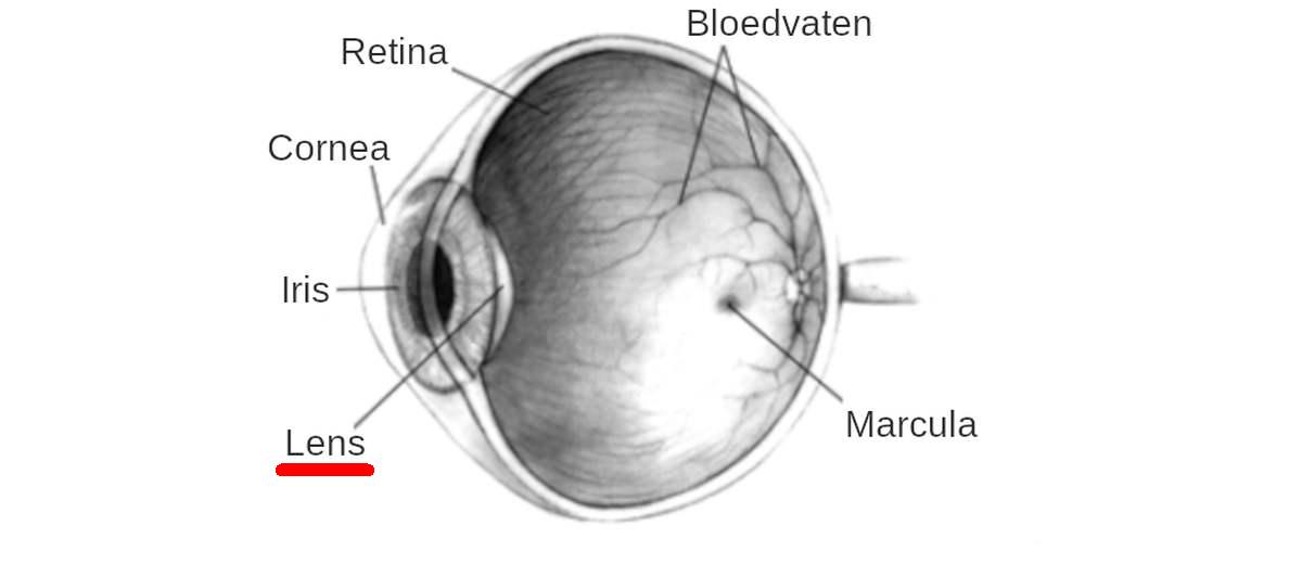 Lensluxatie bij een Tibetaanse Terriër