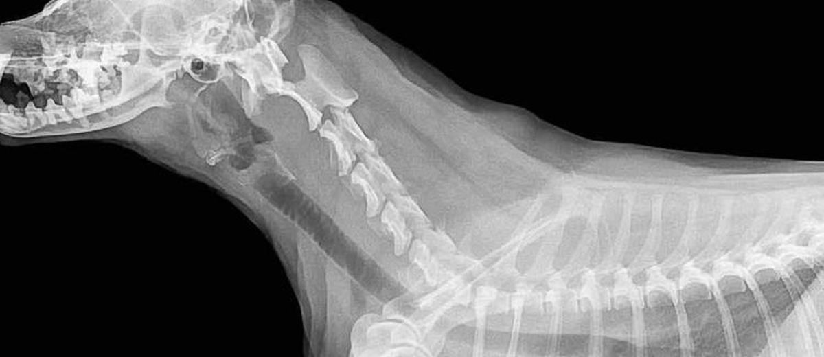 Discus hernia