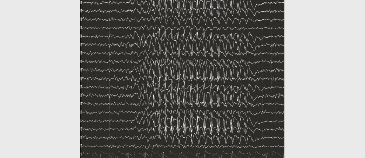 Epilepsie  bij een Portugese Podengo