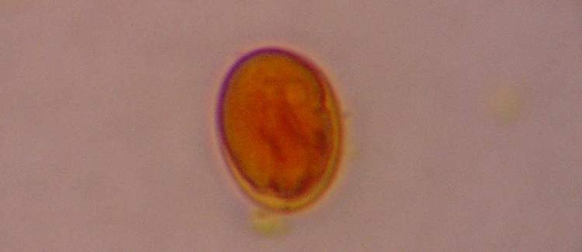 Giardia 