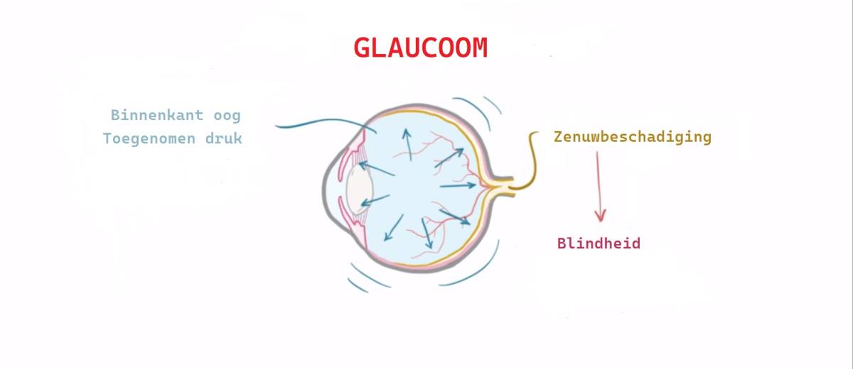 Glaucoom, groene staar, verhoogde oogdruk bij een Akita