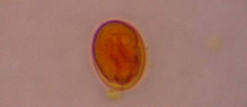 Giardia